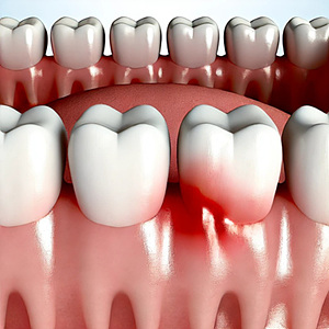뜨거운물을마실때치아가아프면 지금 바로 실천하세요