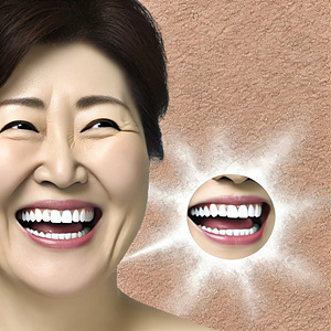 잇몸 치료 잇몸 염증 관리만 잘해도 효과를 느껴보세요